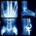 National award for programme to reduce infection rates in joint replacement surgery thumbnail image